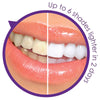 Professional Teeth Whitening Home Kit