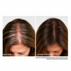 Igia Infrared Hair Growth Comb