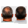 Igia Infrared Hair Growth Comb