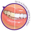 Remedy Health Professional Teeth Whitening Kit – Complete LED Teeth Whitening System